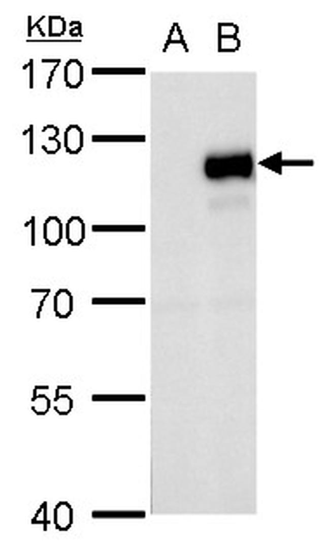 MKL1 Antibody in Western Blot (WB)