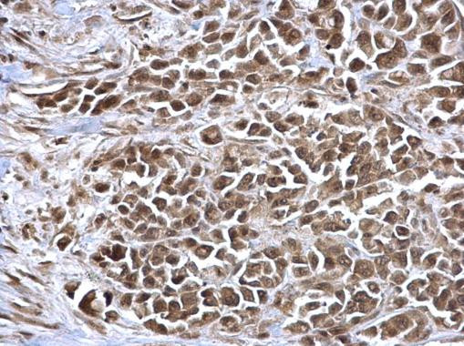 NAV2 Antibody in Immunohistochemistry (Paraffin) (IHC (P))