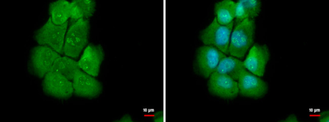 NOLC1 Antibody in Immunocytochemistry (ICC/IF)