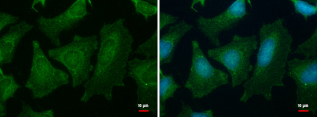 PGM1 Antibody in Immunocytochemistry (ICC/IF)