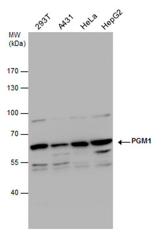 PGM1 Antibody in Western Blot (WB)