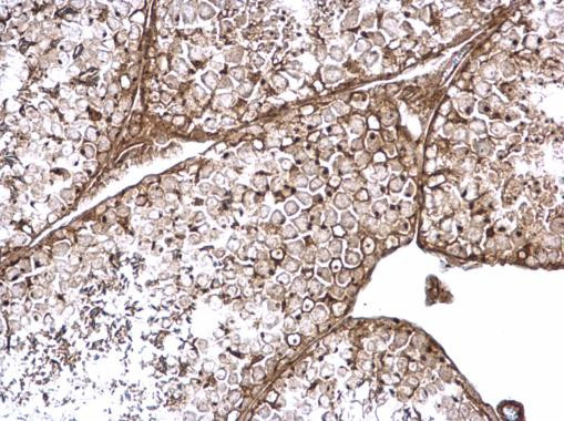 Rab11fip4 Antibody in Immunohistochemistry (Paraffin) (IHC (P))