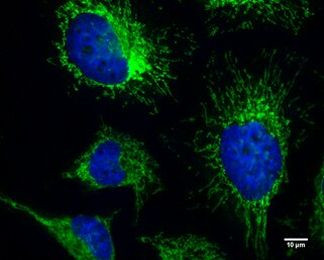 FIP200 Antibody in Immunocytochemistry (ICC/IF)