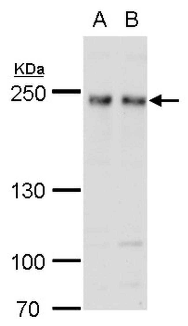 FIP200 Antibody in Western Blot (WB)