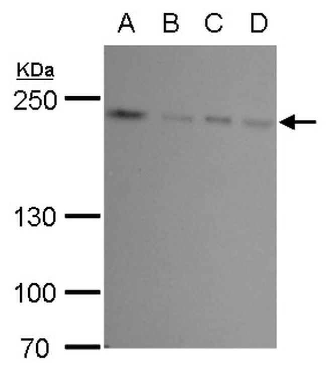 FIP200 Antibody in Western Blot (WB)