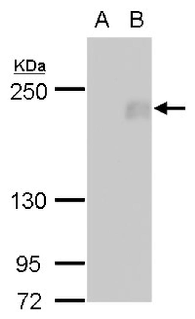 FIP200 Antibody in Western Blot (WB)