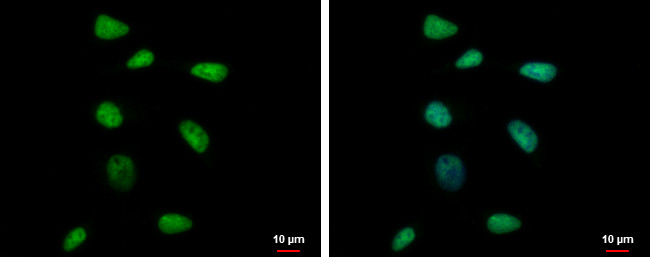 RPP40 Antibody in Immunocytochemistry (ICC/IF)