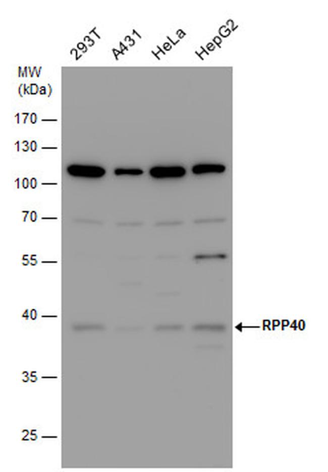 RPP40 Antibody in Western Blot (WB)