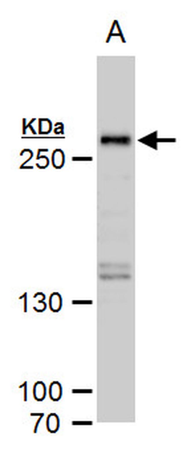 SETD1A Antibody in Western Blot (WB)