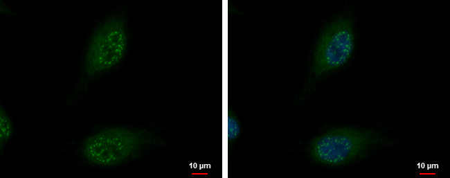 SON Antibody in Immunocytochemistry (ICC/IF)