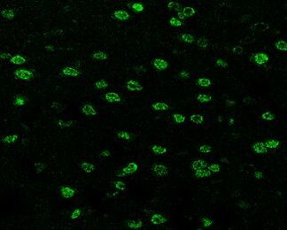 SOX3 Antibody in Immunohistochemistry (Paraffin) (IHC (P))