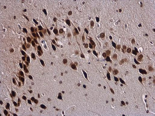 SOX3 Antibody in Immunohistochemistry (Paraffin) (IHC (P))