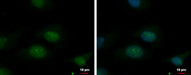 TBL3 Antibody in Immunocytochemistry (ICC/IF)