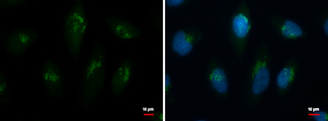 TMF1 Antibody in Immunocytochemistry (ICC/IF)