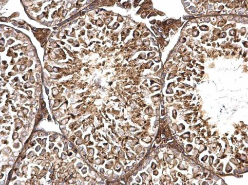 TMF1 Antibody in Immunohistochemistry (Paraffin) (IHC (P))