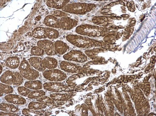 VEPH1 Antibody in Immunohistochemistry (Paraffin) (IHC (P))