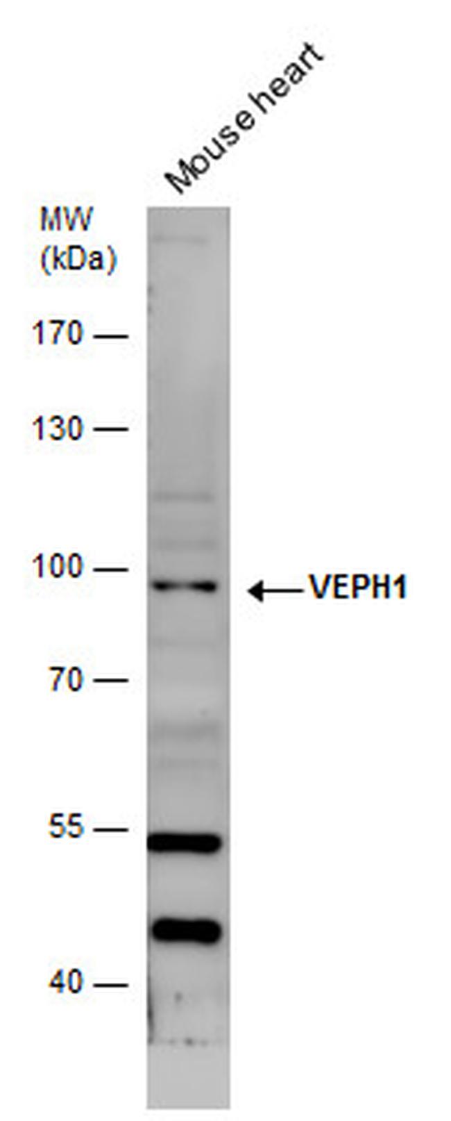 VEPH1 Antibody in Western Blot (WB)