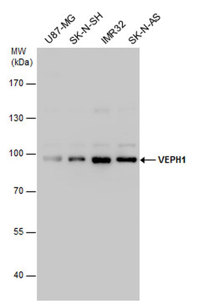 VEPH1 Antibody in Western Blot (WB)