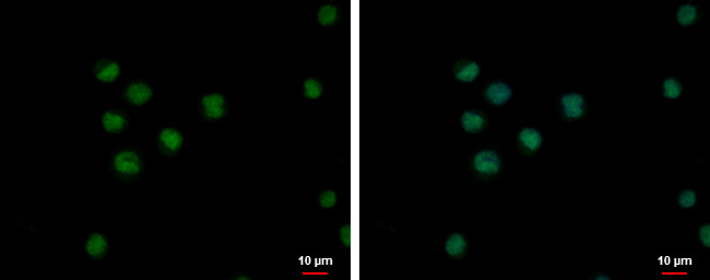 ZNF33A Antibody in Immunocytochemistry (ICC/IF)