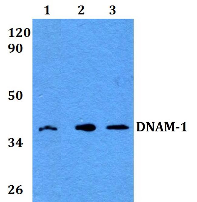 CD226 Antibody in Western Blot (WB)