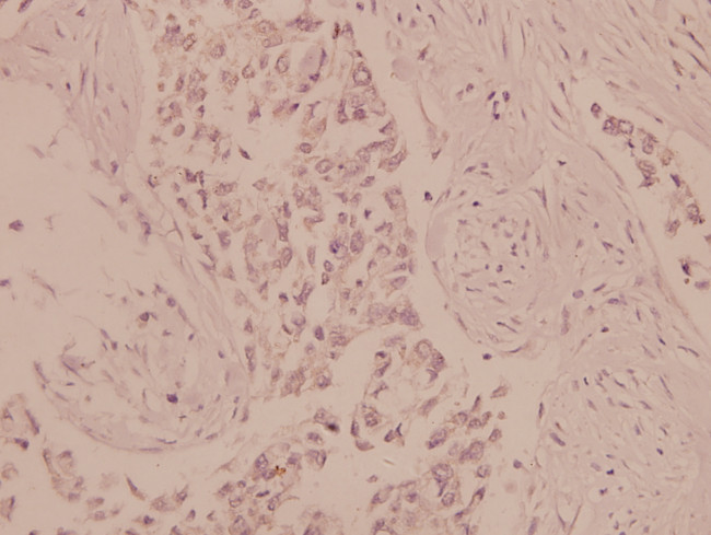 AMPK alpha-1,2 Antibody in Immunohistochemistry (Paraffin) (IHC (P))