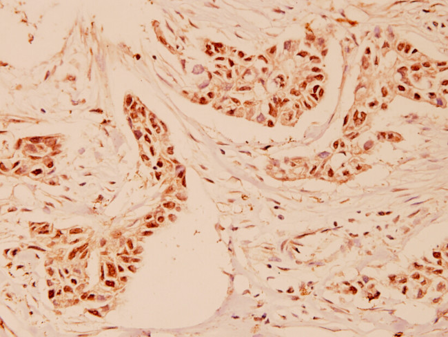 Cyclin A Antibody in Immunohistochemistry (Paraffin) (IHC (P))