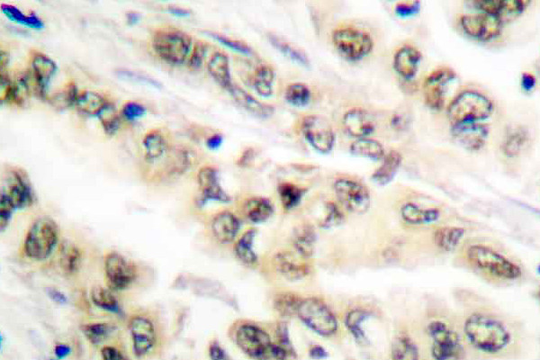 E2F4/E2F5 Antibody in Immunohistochemistry (Paraffin) (IHC (P))