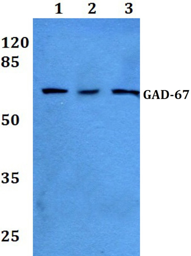 GAD67 Antibody in Western Blot (WB)