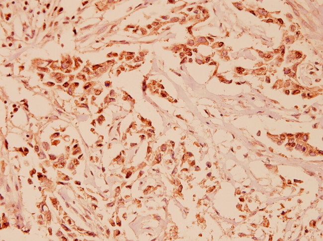 NRG1 Antibody in Immunohistochemistry (Paraffin) (IHC (P))