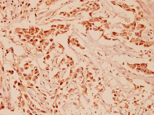 NRG1 Antibody in Immunohistochemistry (Paraffin) (IHC (P))