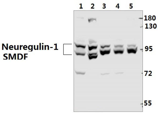 NRG1 Antibody in Western Blot (WB)