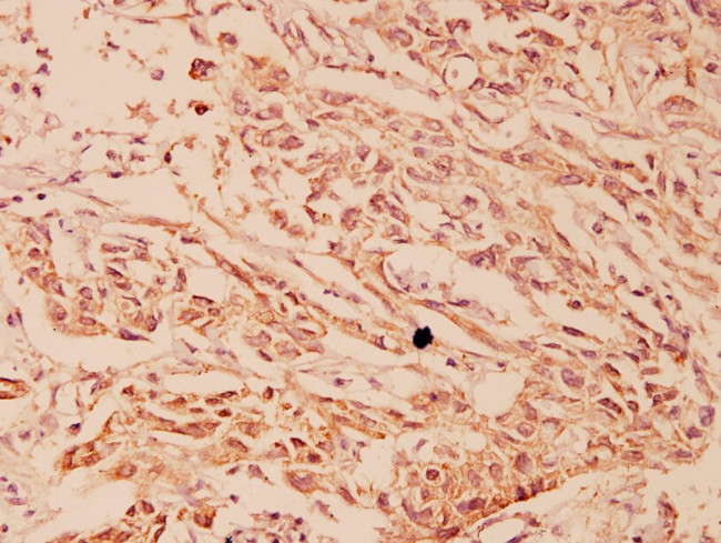 HSP105 Antibody in Immunohistochemistry (Paraffin) (IHC (P))