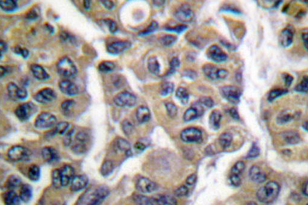 MAGE1 Antibody in Immunohistochemistry (Paraffin) (IHC (P))