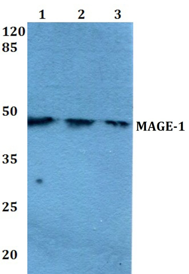 MAGE1 Antibody in Western Blot (WB)