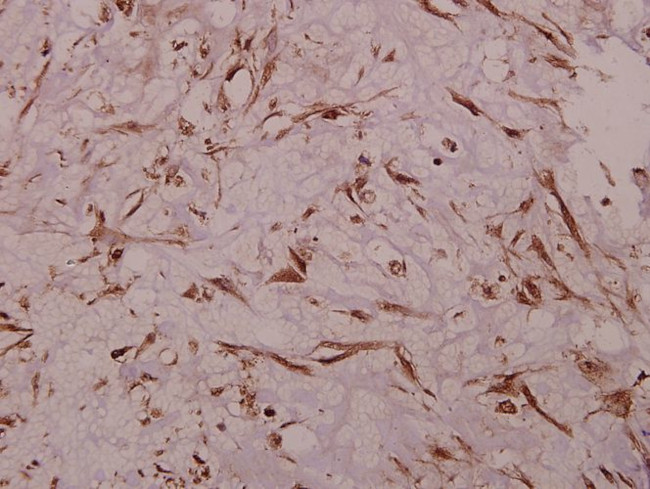 Sodium Channel Pan Antibody in Immunohistochemistry (Paraffin) (IHC (P))