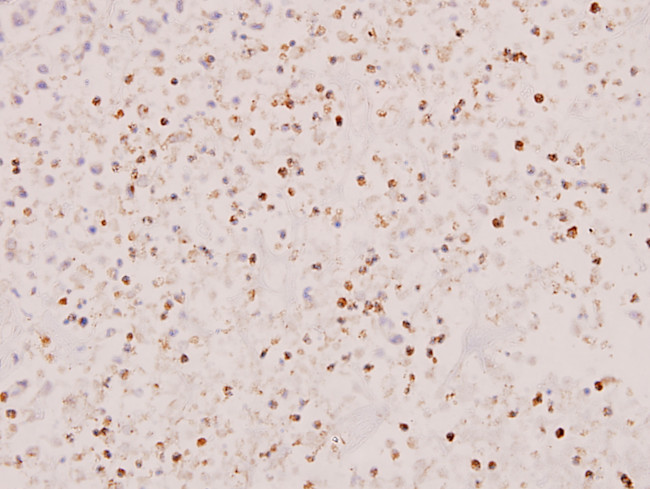 STAT5 alpha/beta Antibody in Immunohistochemistry (Paraffin) (IHC (P))