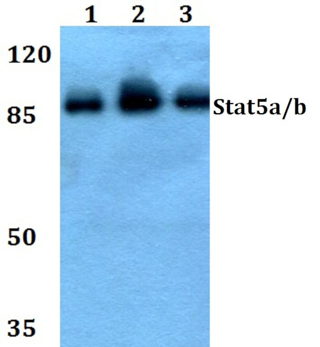 STAT5 alpha/beta Antibody in Western Blot (WB)