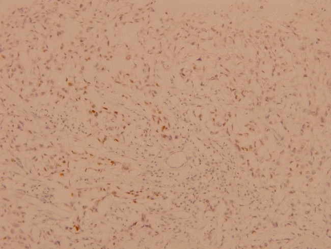 FOXO1/FOXO3/FOXO4 Antibody in Immunohistochemistry (Paraffin) (IHC (P))