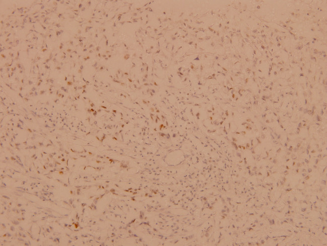 FOXO1/FOXO3/FOXO4 Antibody in Immunohistochemistry (Paraffin) (IHC (P))