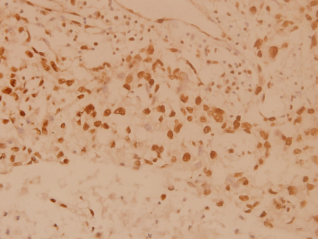 MSK1 Antibody in Immunohistochemistry (Paraffin) (IHC (P))