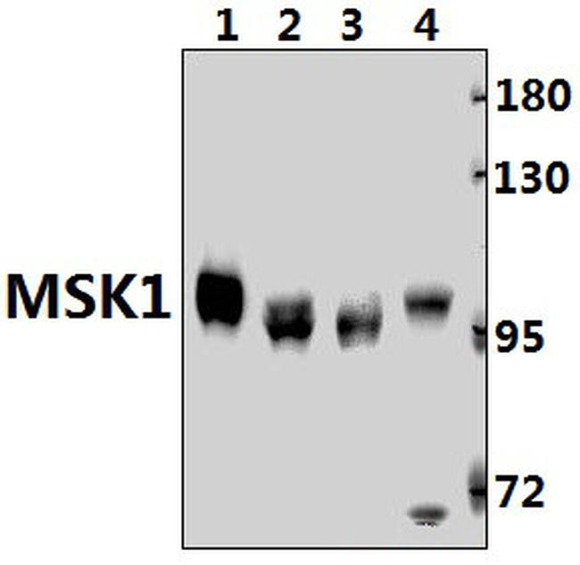 MSK1 Antibody in Western Blot (WB)