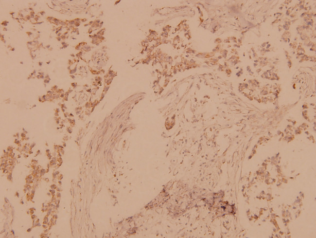 MST1/MST2 Antibody in Immunohistochemistry (Paraffin) (IHC (P))