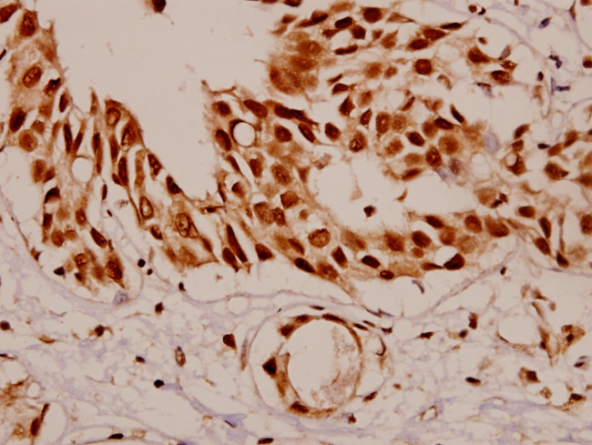 SF1 Antibody in Immunohistochemistry (Paraffin) (IHC (P))