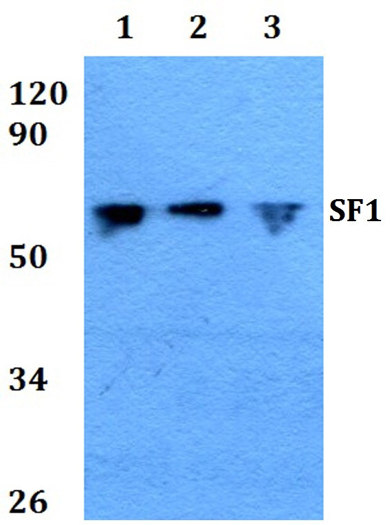 SF1 Antibody in Western Blot (WB)