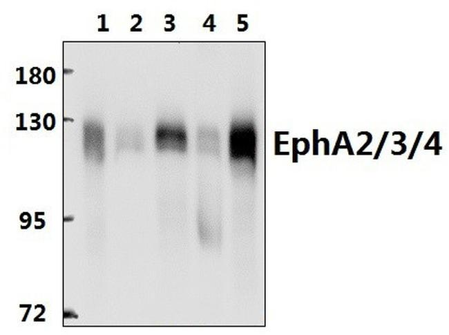 EphA2/EphA3/EphA4 Antibody in Western Blot (WB)