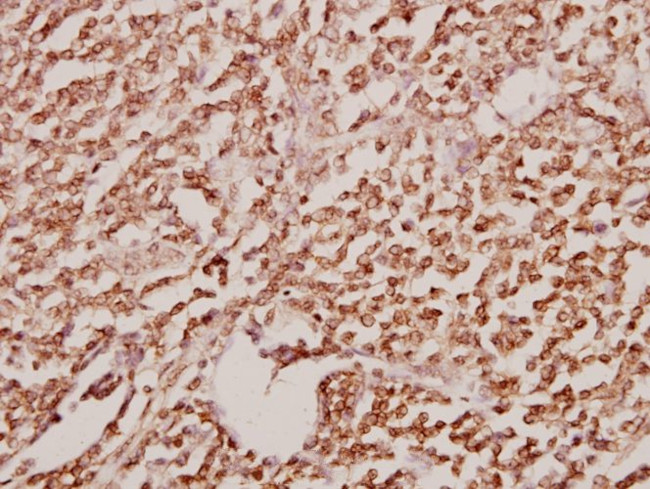 GATA2/GATA3 Antibody in Immunohistochemistry (Paraffin) (IHC (P))