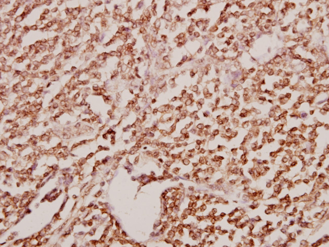 GATA2/GATA3 Antibody in Immunohistochemistry (Paraffin) (IHC (P))