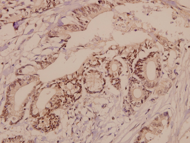 TGFBR2 Antibody in Immunohistochemistry (Paraffin) (IHC (P))