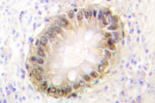 SMAD2/SMAD3 Antibody in Immunohistochemistry (Paraffin) (IHC (P))