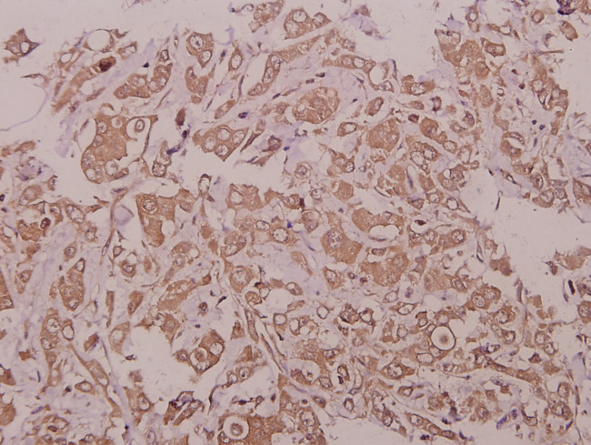 LZK Antibody in Immunohistochemistry (Paraffin) (IHC (P))